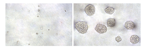 紫杉醇对HeLa 细胞锚定非依赖性生长的抑制.png