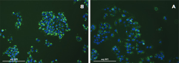 用U-18666A阻断细胞内胆固醇运输，从而增加NBD胆固醇摄取.jpg