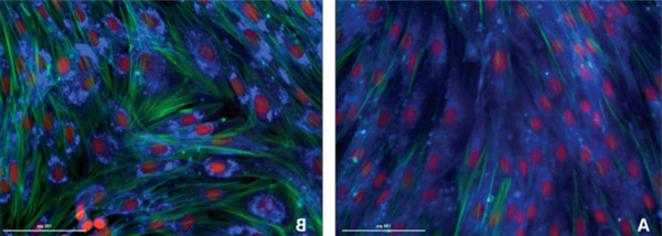 U-18666A改变了成纤维细胞中胆固醇的定位.jpg